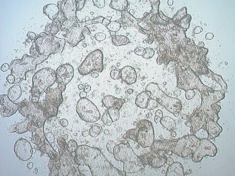 10719 Organoidy jelitowe dwunastnicy, wiek 45 lat (preparat 83-D) Cryopreserved patient derived gastrointestinal organoids (PDOs)