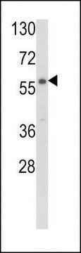 ANTI-CARS2(C-TERMINAL) antibody produced in rabbit purified immunoglobulin, buffered aqueous solution