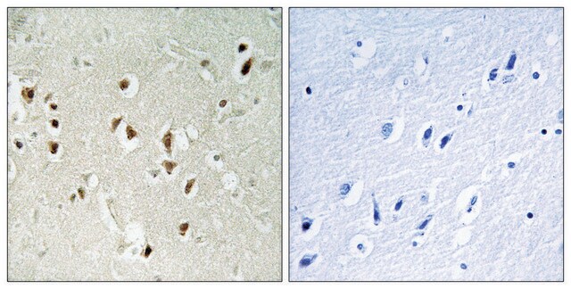 Anti-GRF-1 antibody produced in rabbit affinity isolated antibody