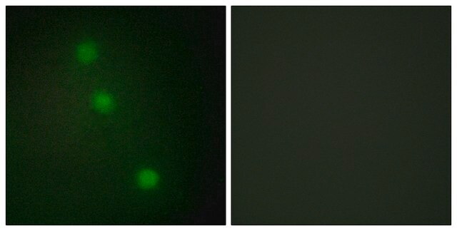 Anti-ATF1 antibody produced in rabbit affinity isolated antibody