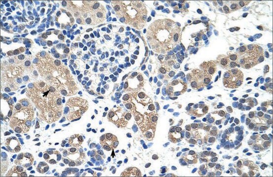 抗NR2F2抗体 ウサギ宿主抗体 affinity isolated antibody