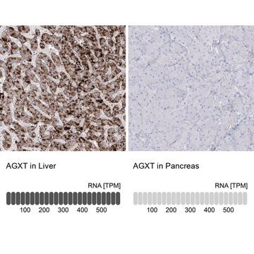 Anti-AGXT antibody produced in rabbit Prestige Antibodies&#174; Powered by Atlas Antibodies, affinity isolated antibody, buffered aqueous glycerol solution