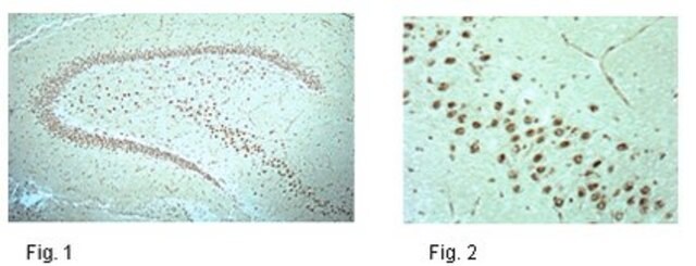 Anti-phospho NR1 (Ser897) Antibody from rabbit, purified by affinity chromatography