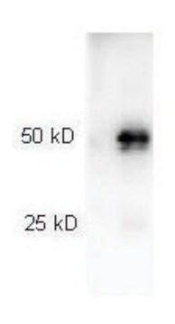 Anti-Rabbit IgG (H+L), highly cross adsorbed-Peroxidase antibody produced in goat affinity isolated antibody, lyophilized powder