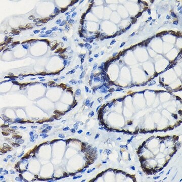 Anti-SATB2 antibody produced in rabbit