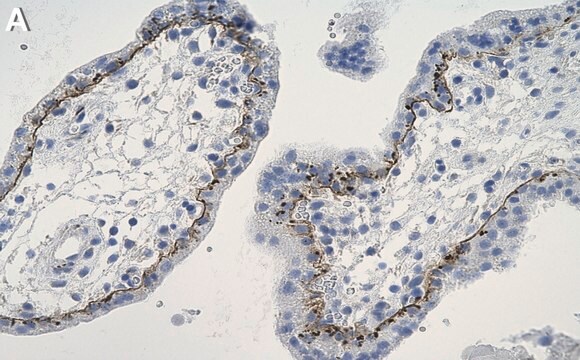 Anti-Laminin &#946;1 Antibody, clone 4E10 ZooMAb&#174; Mouse Monoclonal recombinant, expressed in HEK 293 cells