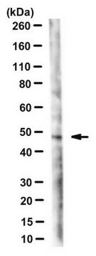 Anti-Serpina3n Antibody, clone 13H5 clone 13H5, from hamster(Armenian)