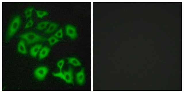 Anti-FZD4 antibody produced in rabbit affinity isolated antibody