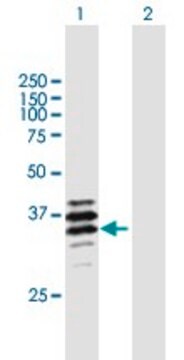 Anti-PPT2 antibody produced in mouse purified immunoglobulin, buffered aqueous solution