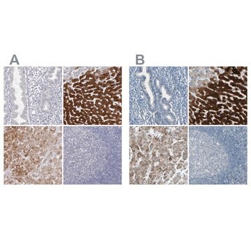 抗CYP2E1抗体 ウサギ宿主抗体 Prestige Antibodies&#174; Powered by Atlas Antibodies, affinity isolated antibody, buffered aqueous glycerol solution