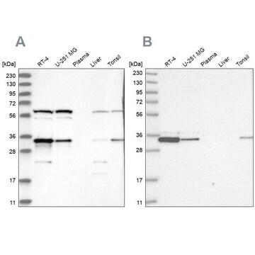 Anti-PRKRA antibody produced in rabbit Prestige Antibodies&#174; Powered by Atlas Antibodies, affinity isolated antibody