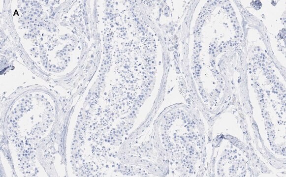 抗GAPDH抗体 クローン10B13 ZooMAb&#174; ウサギモノクローナル recombinant, expressed in HEK 293 cells