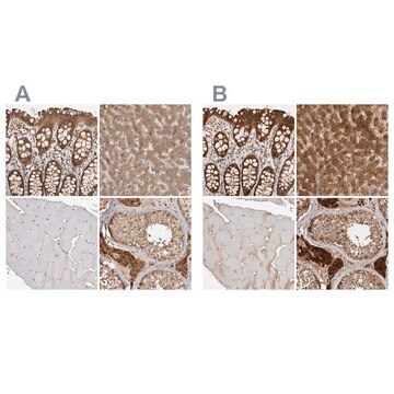 Anti-ACAT2 antibody produced in rabbit Prestige Antibodies&#174; Powered by Atlas Antibodies, affinity isolated antibody, buffered aqueous glycerol solution, Ab1