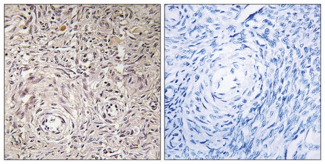 Anti-GCNT7 antibody produced in rabbit affinity isolated antibody