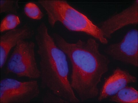 Anti-phospho-Th (pSer19) antibody produced in rabbit affinity isolated antibody