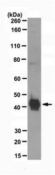 Anti-phospho-SMAD3 (Tyr179) Antibody from rabbit, purified by affinity chromatography