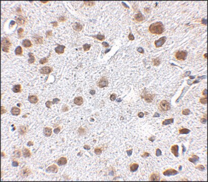 Anti-FTO antibody produced in rabbit affinity isolated antibody, buffered aqueous solution