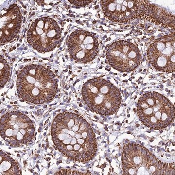 Anti-NDUFAF1 antibody produced in rabbit Prestige Antibodies&#174; Powered by Atlas Antibodies, affinity isolated antibody, buffered aqueous glycerol solution