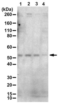 Anti-phospho-Parkin (Ser65) purified antibody, from rabbit