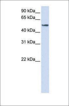 抗 USP22 (ab2) 兔抗 affinity isolated antibody