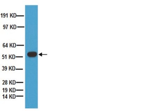 Anticuerpo anti-triptófano hidroxilasa Chemicon&#174;, from sheep