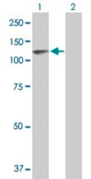 Anti-TPO antibody produced in mouse purified immunoglobulin, buffered aqueous solution