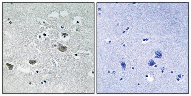 抗 SREBP-1 兔抗 affinity isolated antibody