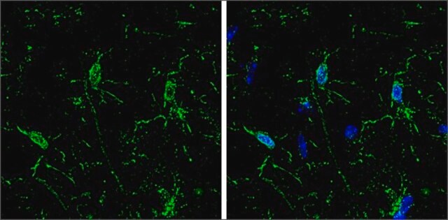 モノクローナル抗Iba1 マウス宿主抗体 clone GT10312, affinity isolated antibody