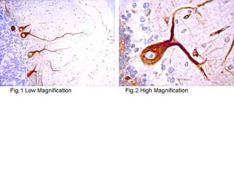 Anti-IP3 Receptor 1 Antibody serum, from rabbit