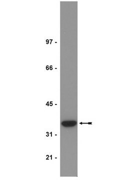 Przeciwciało anty-PP2A, podjednostka C, demetylowana, klon 4b7 ascites fluid, clone 4b7, Upstate&#174;