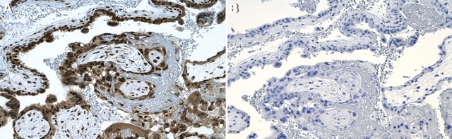 Przeciwciało anty-CyclinE, klon 1C7 10889 Królik monoklonalny recombinant, expressed in HEK 293 cells