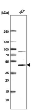 Monoclonal Anti-Cmpk2 Antibody Produced In Mouse Prestige Antibodies&#174; Powered by Atlas Antibodies, clone CL14486, affinity isolated antibody, buffered aqueous glycerol solution