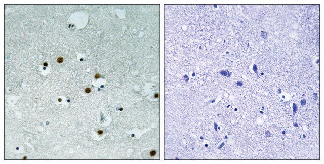 Anti-HP1 &#945; antibody produced in rabbit affinity isolated antibody