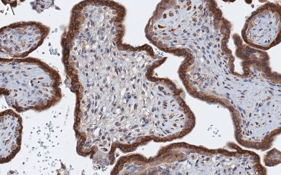 Anti-ATF6&#945; Antibody, clone 1F11 ZooMAb&#174; Rabbit Monoclonal recombinant, expressed in HEK 293 cells