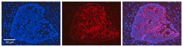 抗HMOX1抗体 affinity isolated antibody