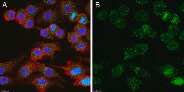 Anti-CD25 Antibody, clone 7D4