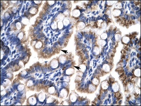 Anti-ATF5 (AB1) antibody produced in rabbit affinity isolated antibody