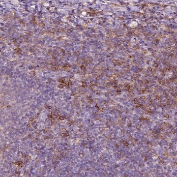 Anti-SEMA4A antibody produced in rabbit Prestige Antibodies&#174; Powered by Atlas Antibodies, affinity isolated antibody, buffered aqueous glycerol solution