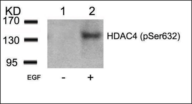 Anti-phospho-HDAC4 (pSer632) antibody produced in rabbit affinity isolated antibody