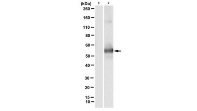 Przeciwciało anty-fosfo-cytokeratyna-8 (K8) (Ser73), klon LJ4 clone LJ4, from mouse