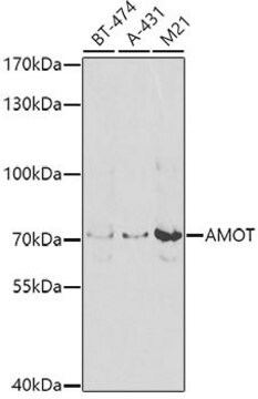 Anti- AMOT antibody produced in rabbit