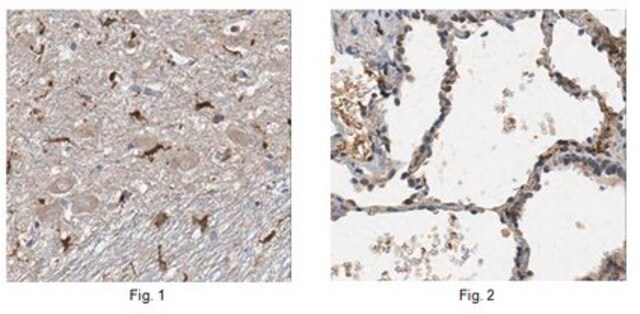 Anticuerpo anti-ORMDL3 from rabbit, purified by affinity chromatography