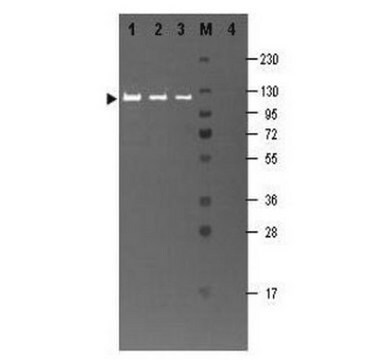 Anti-&#946; Galactosidase-Antikörper Chemicon&#174;, from rabbit