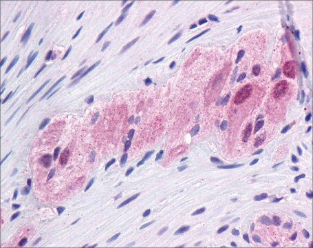 Anti-FOXC1, (N-terminal) antibody produced in rabbit affinity isolated antibody