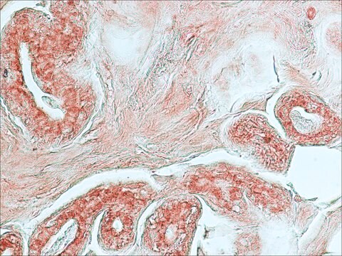 Monoclonal Anti-Cathepsin D antibody produced in mouse clone CTD-19, ascites fluid