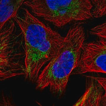 抗SFXN3抗体 ウサギ宿主抗体 Prestige Antibodies&#174; Powered by Atlas Antibodies, affinity isolated antibody