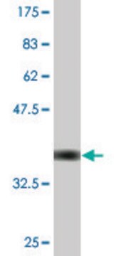 Monoclonal Anti-CECR1, (C-terminal) antibody produced in mouse clone 3D11, purified immunoglobulin, buffered aqueous solution