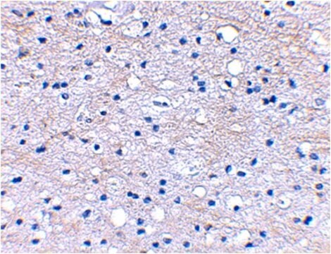 Anti-BRAL1 Antibody from rabbit, purified by affinity chromatography