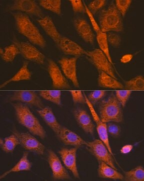 Anti-PEN2/PSENEN Antibody, clone 6J5O4, Rabbit Monoclonal