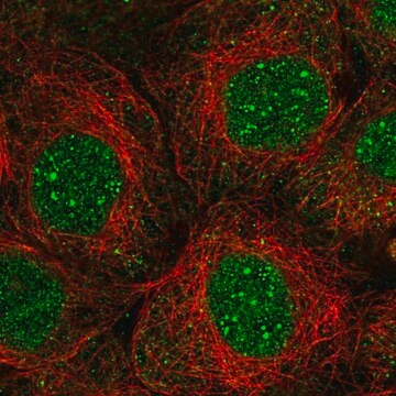 Anti-TMEM62 antibody produced in rabbit Prestige Antibodies&#174; Powered by Atlas Antibodies, affinity isolated antibody